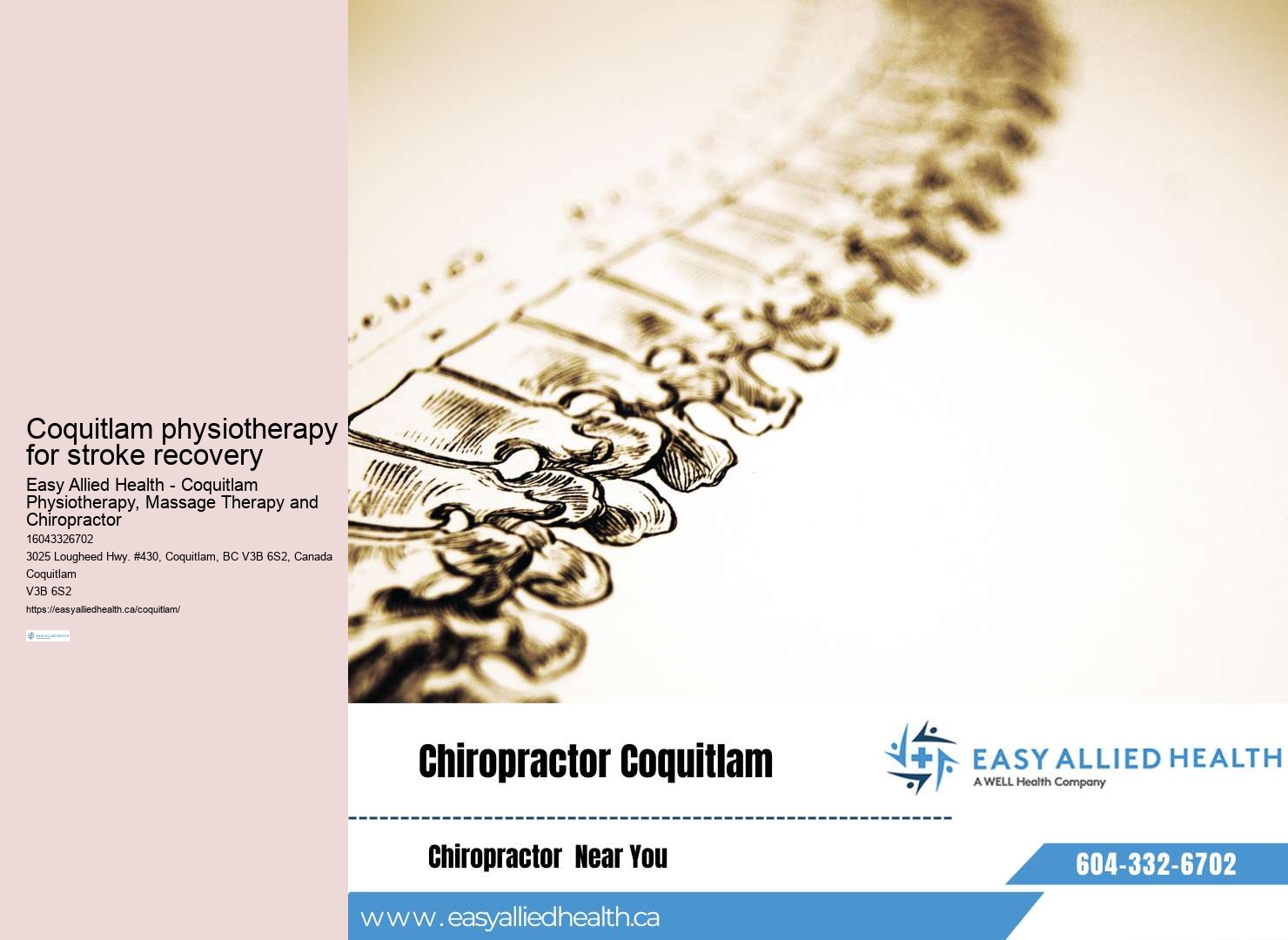 Coquitlam physiotherapy for kyphosis