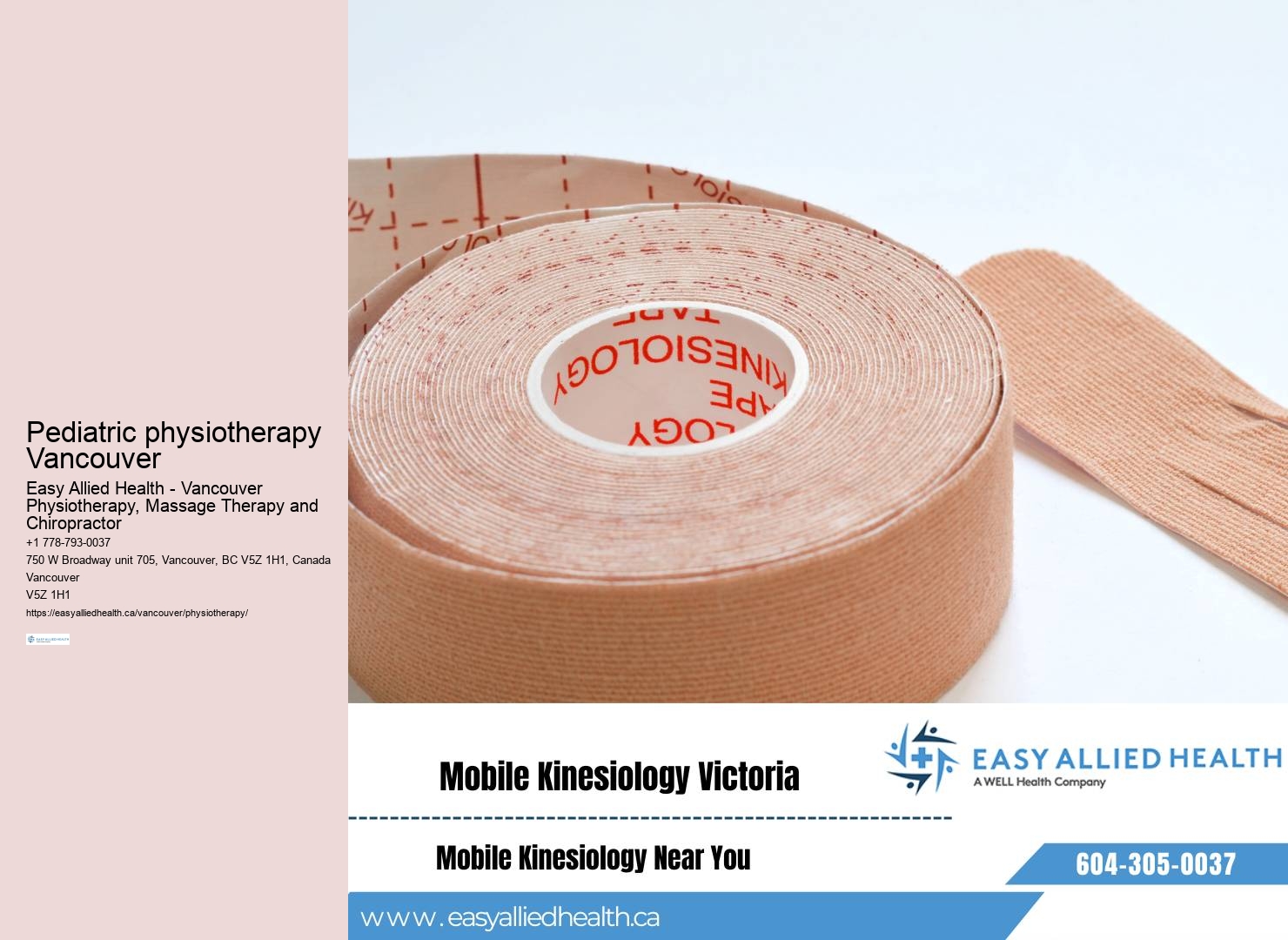 Vancouver physiotherapy for vertigo